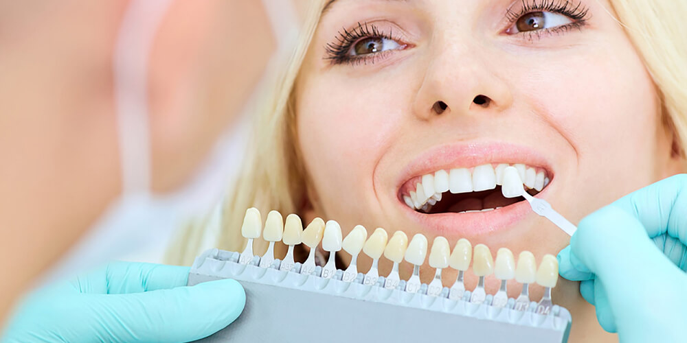 Emax Veneers in Turkey