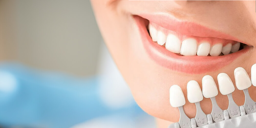 Laminate Veneers in Turkey