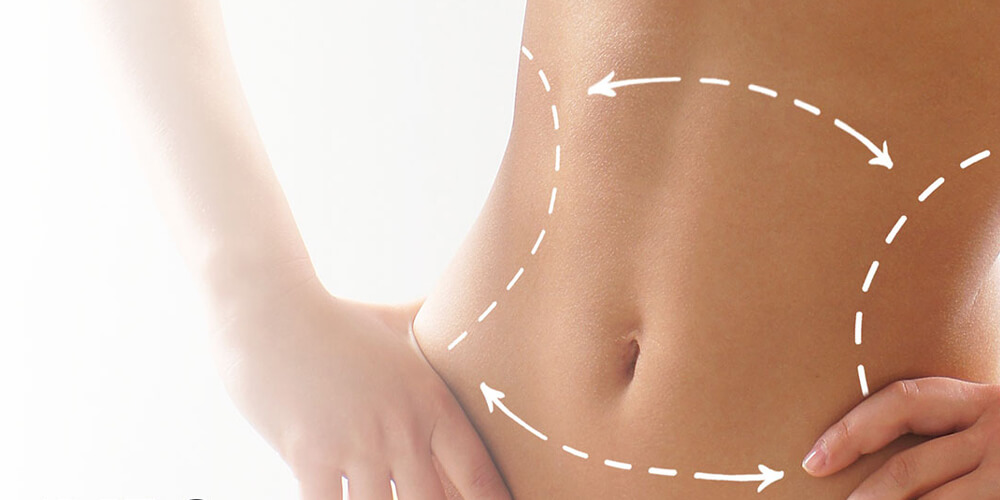 Liposuction in Turkey
